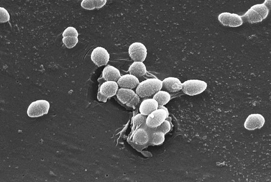 The bacterium, Enterococcus faecalis, which lives in the human gut, is just one microbe type that will be studied as part of NIH's Human Microbiome Project