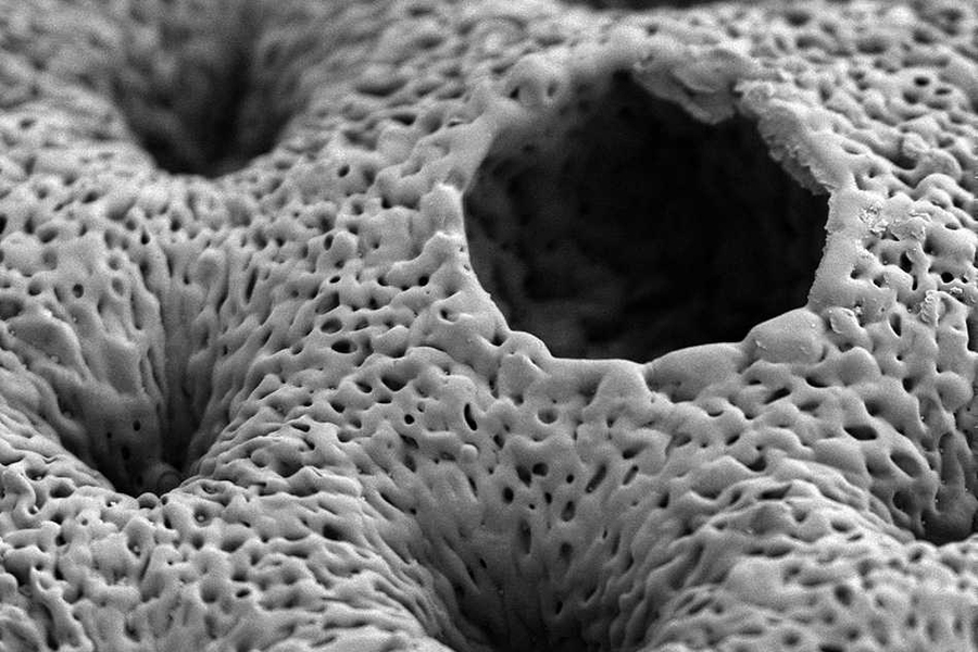 Pictured is a scanning electron micrograph of a porous, nanostructured poly(lactic-co-glycolic acid) (PLGA) membrane. The membrane is coated with a polyelectrolyte (PEM) multilayer coating that releases growth factors to promote bone repair.