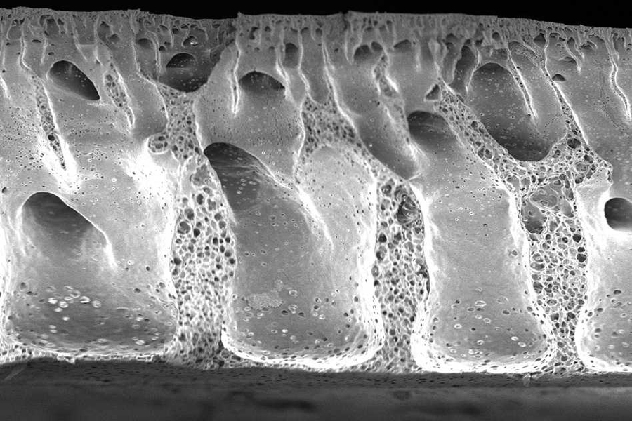 Pictured is a scanning electron micrograph of a porous, nanostructured poly(lactic-co-glycolic acid) (PLGA) membrane. The membrane is coated with a polyelectrolyte (PEM) multilayer coating that releases growth factors to promote bone repair.