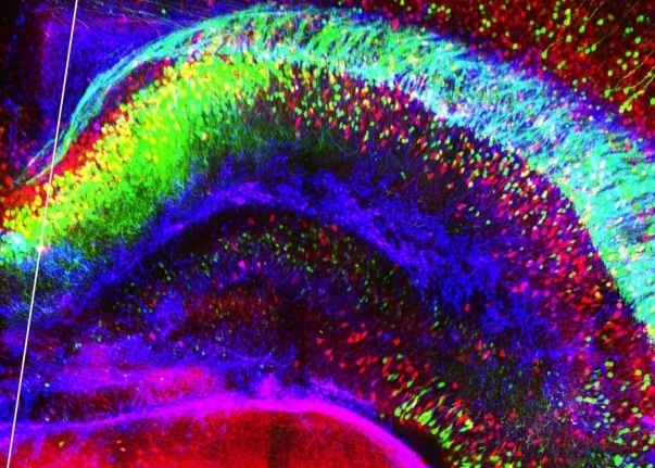 An immunostaining process known as CLARITY enables better visualization of brain neurons.