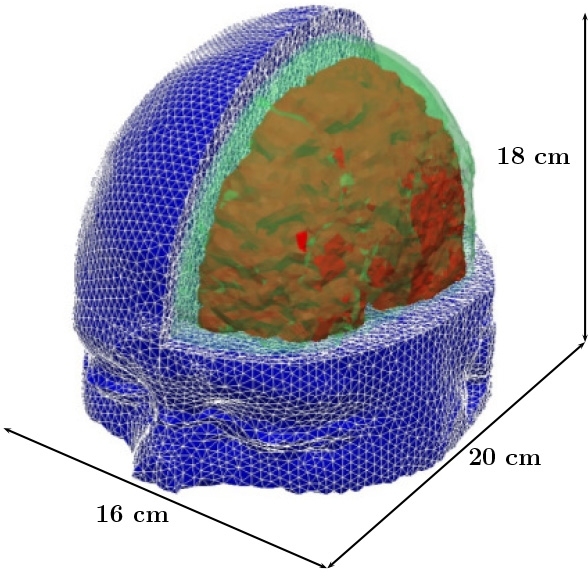 MIT researchers have developed a model of the human head for use in simulations to predict the risk for blast-induced traumatic brain injury. Relevant tissue structures include the skull (green), brain (red), and flesh (blue).