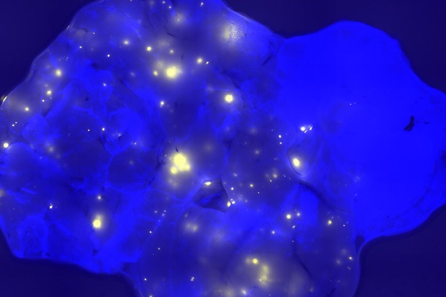 In this pancreatic tissue sample, bright spots represent cells that have undergone a specific genetic alteration.