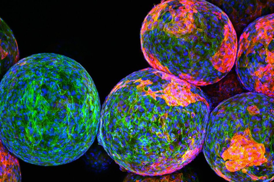 The sugar polymers that make up the spheres in this image are designed to package and protect specially engineered cells that work to produce drugs and fight disease. While on-site, they must remain undetected by the body’s natural defense system. However, the reddish markers on the spheres’ surfaces indicate that immune cells (blue/green) have discovered these invaders and begun to block them...