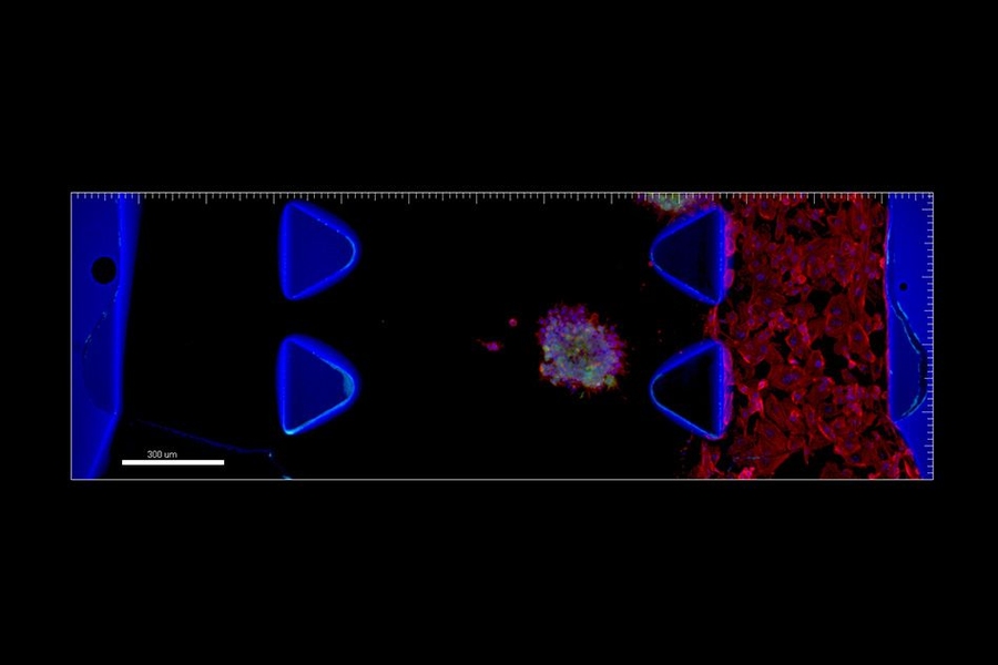 In AIM Biotech's microfluidics device, liver cancer spheroids can be co-cultured with endothelial cells (shown here).