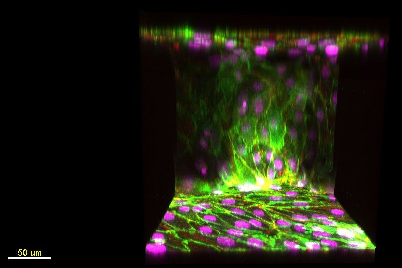 This image shows endothelial cells lining the 2-D media channel, forming a wall of cells along a vertical surface of collagen. Endothelial cell nuclei are shown in purple; vascular-endothelial cadherin, which are involved in cell-to-cell adhesion, are in green.
