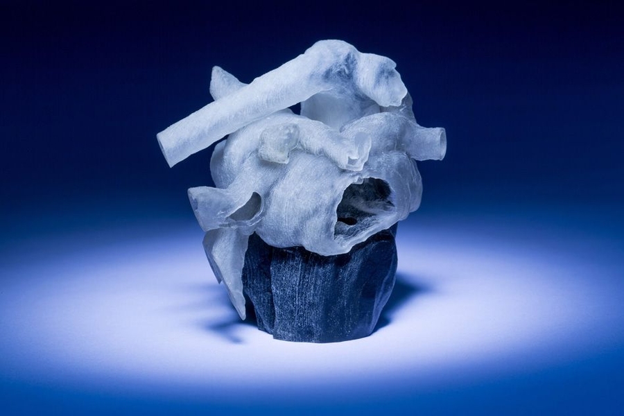 New system from MIT and Boston Children’s Hospital researchers converts MRI scans into 3D-printed heart models (shown here). 
