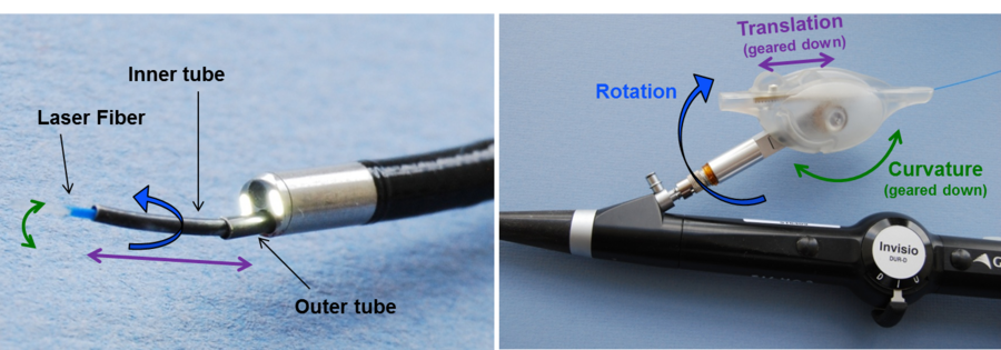 At left, a laser fiber within the inner tube will destroy the overgrown tissue and decompress the spine. At right, a module that surgeons will use to control Laserscope is designed to sit comfortably within the hand and provide precise control over the placement of the laser fiber.