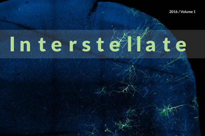 Detail from an Interstellate cover