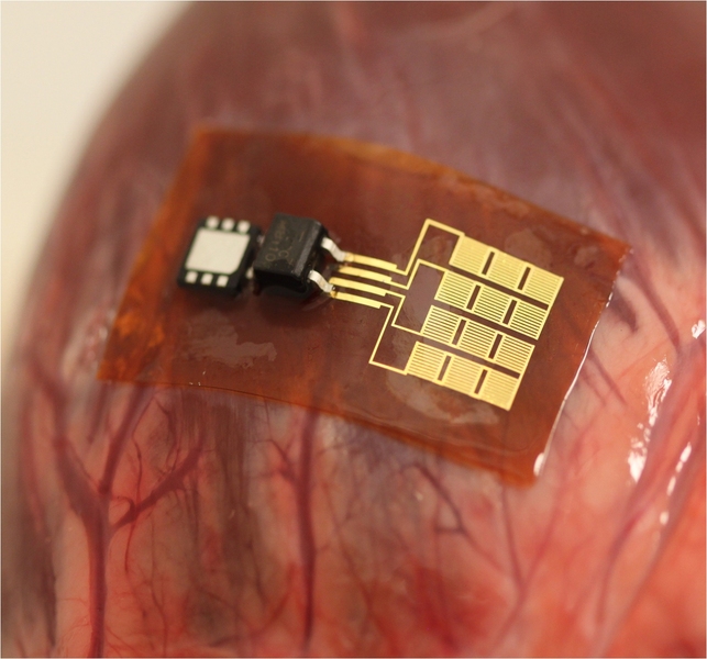 At the Media Lab, Dagdeviren’s Conformable Decoders group is working to create mechanically adaptive electromechanical systems that can intimately integrate with the target object for sensing, actuation, and energy harvesting, among other applications.  Here, a mechanical energy harvester (PZT MEH) is integrated with a chip-scale rechargeable battery and a Schottky bridge rectifier on a bovine h...