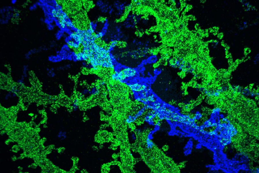 By expanding brain tissue twice, researchers were able to obtain high-resolution images of neurons in the hippocampus.
