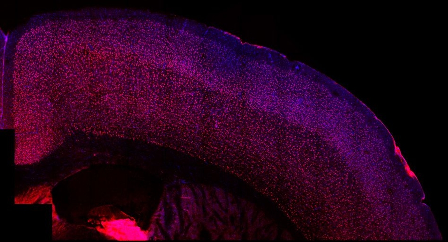 “We identified a very discrete brain region that seems to be modulating all the behaviors associated with this particular model of neurodevelopmental disorder,” says Assistant Professor Gloria Choi. In this image, an irregularity in the somatosensory cortex, called a “patch,” can be seen as a cluster of blue in the brain of a mouse born to a mother that experienced Th17 immune activation d...