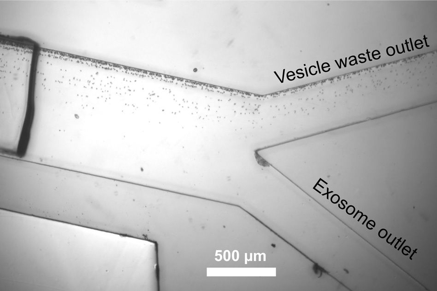 Exosomes are separated from other vesicles as they flow through a microfluidic channel, guided by sound waves.
