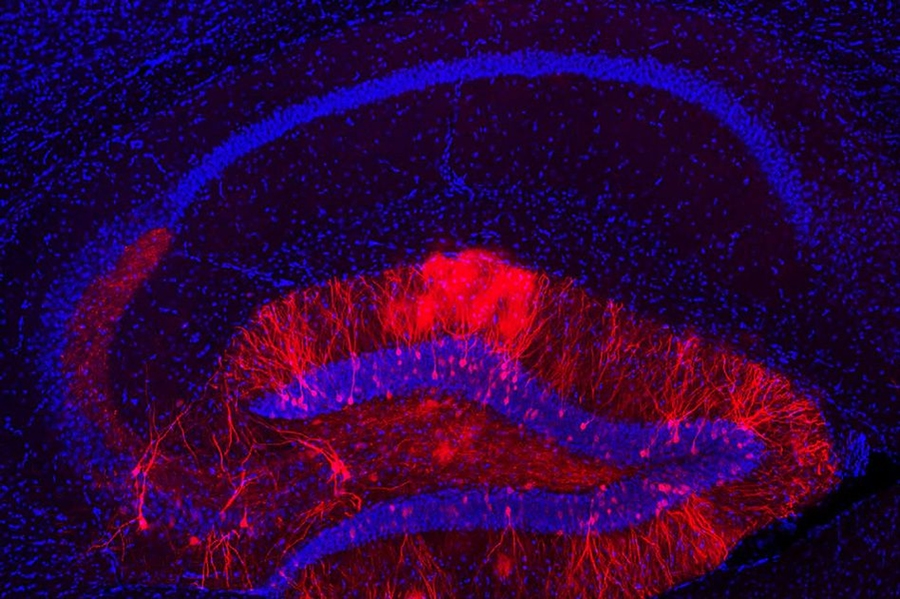 The red staining shows hippocampal dentate gyrus (DG) engram cells, which store a long-term fear memory and have the light sensitive optogenetic protein channelrhodopsin-2. The blue staining shows all cells in the dorsal hippocampus brain region, including non-engram cells (blue color staining only).
