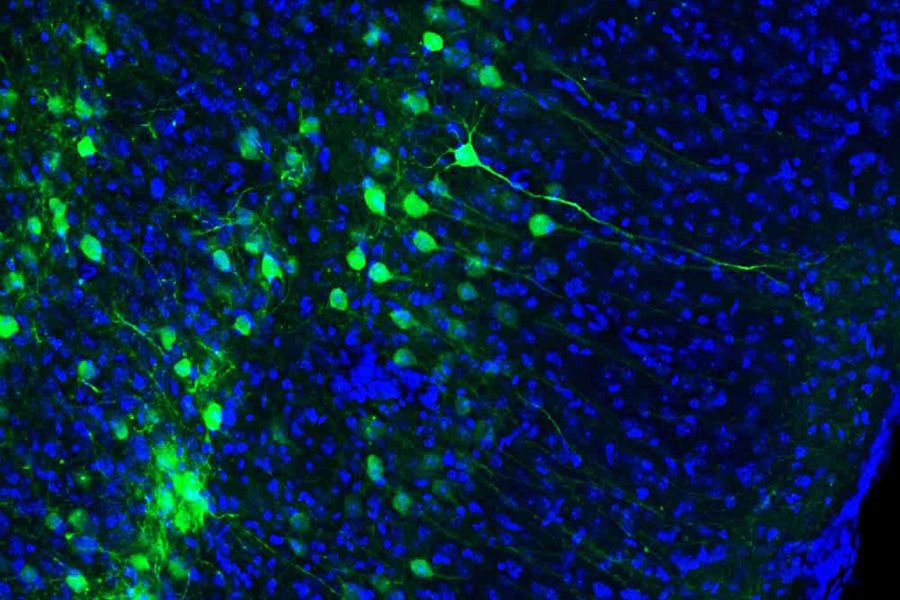The dorsal hippocampus receives spatial and temporal information from an upstream brain region known as the medial entorhinal cortex (MEC). Green staining shows MEC engram cells, which store a long-term fear memory and have the light sensitive optogenetic protein channelrhodopsin-2. Blue staining shows all cells in the MEC brain region, including non-engram cells (blue color staining only). 
