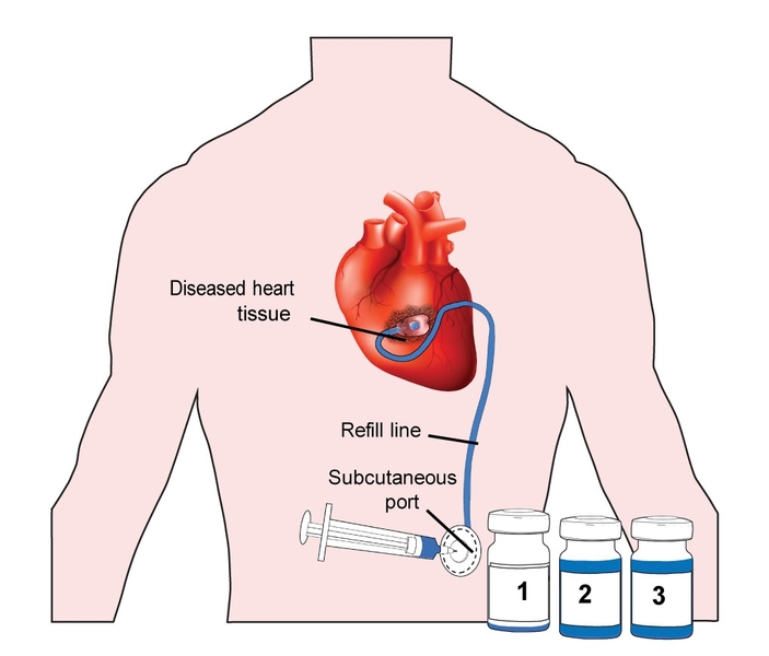 An overview of the vision for the clinical translation of Therepi and its realization for pre-clinical evaluation