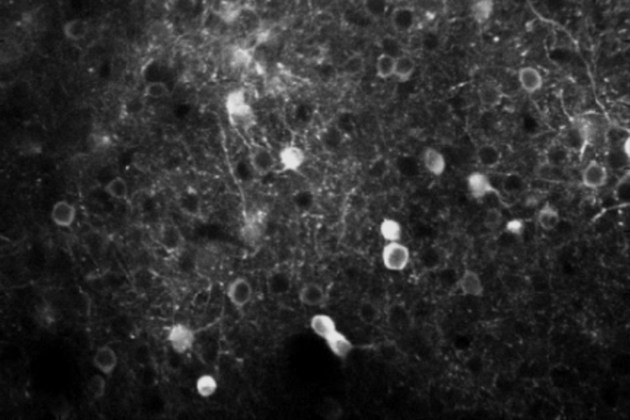 PPC neurons, engineered to glow when active, flicker in response to a mouse seeing a visual stimulus and deciding whether to respond with a licking motion.