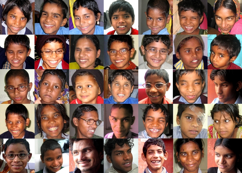 Since it was founded in 2004, Project Prakash has provided 500 surgeries and 43,000 opthalmic screenings to children in need. 