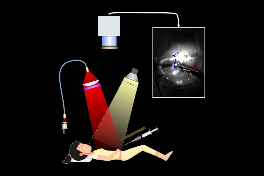 Researchers at MIT and MGH have developed an image-guided surgical system that could help surgeons better visualize and remove tiny ovarian tumors. Fluorescent carbon nanotubes are used as probes to bind to the tumors, making them easier to see. 