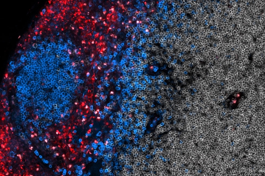 A zoomed in image of T cells (shown in red) being activated with a vaccine that accumulates in the lymph nodes. B cells in the lymph nodes are labeled in blue.