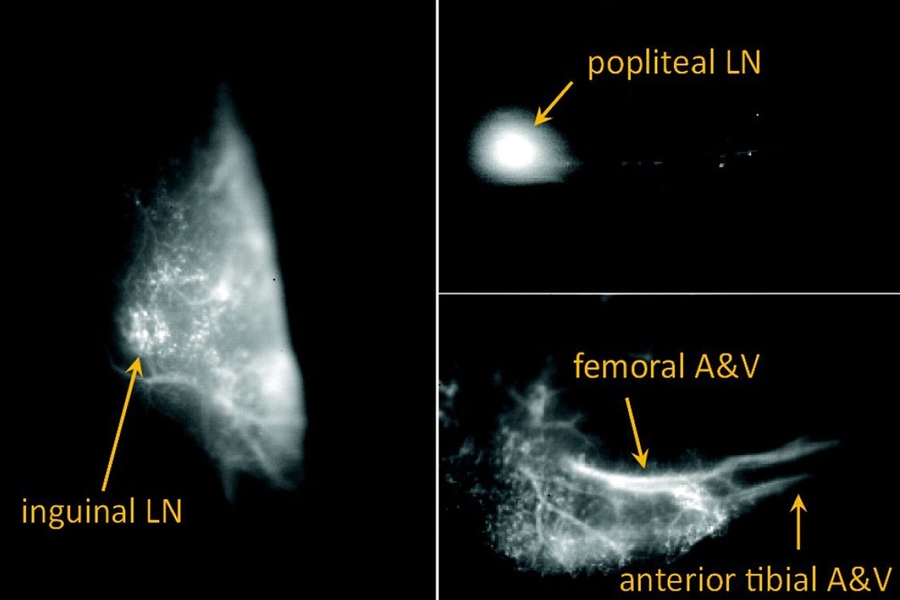 A bright fluorescent quantum defect can be a tool to upgrade current biomedical imaging systems, looking at even smaller tumors through the defect emission.
