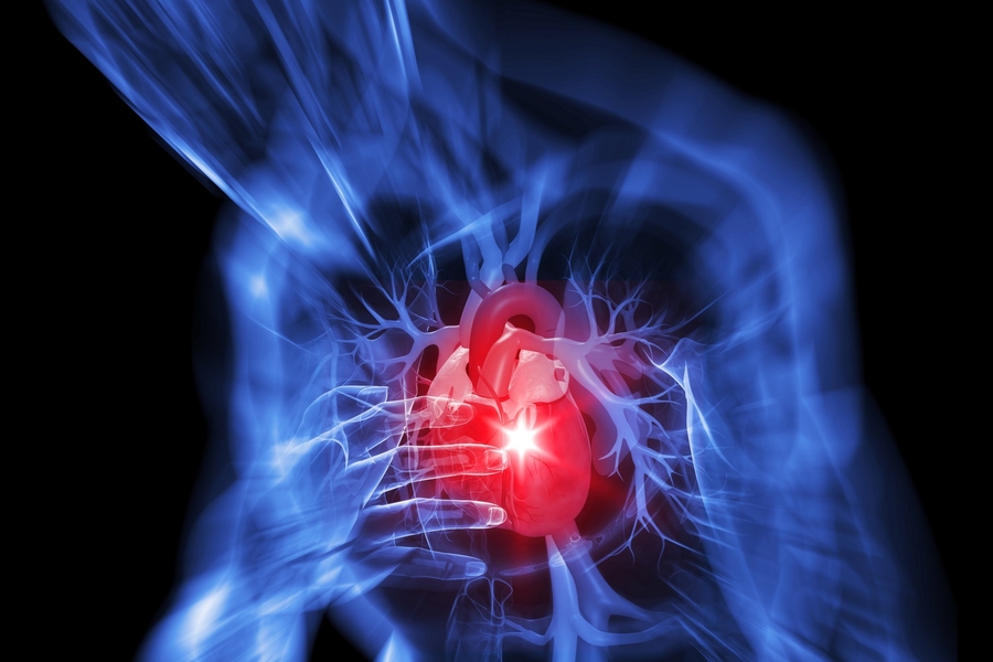 "The terms ‘typical’ and ‘atypical’ angina should be abandoned, as they do not correlate with disease and may perpetuate stereotypes based on sex," Media Lab researcher Karthik Dinakar and his colleagues conclude.
