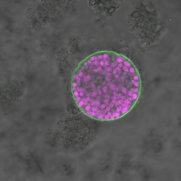 Experiments identified one gene, which the researchers named Bradyzoite-Formation Deficient 1 (BFD1), as the only gene both sufficient and necessary to prevent the transition from tachyzoite to bradyzoite stages of <i>T. gondii</i> infection. The findings may inform research into potential therapies for toxoplasmosis, or even a vaccine.