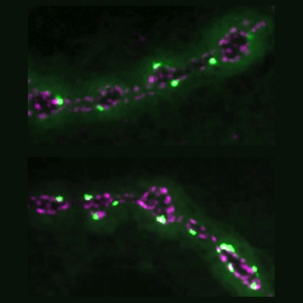 Researchers have found that a protein called SYT7 appears to limit activity at neural connections called synapses. Here, synapses glowing light green are engaged in neurotransmitter release. Notably, there are many more such synapses in the bottom panel, where a protein called SYT7 was knocked out.