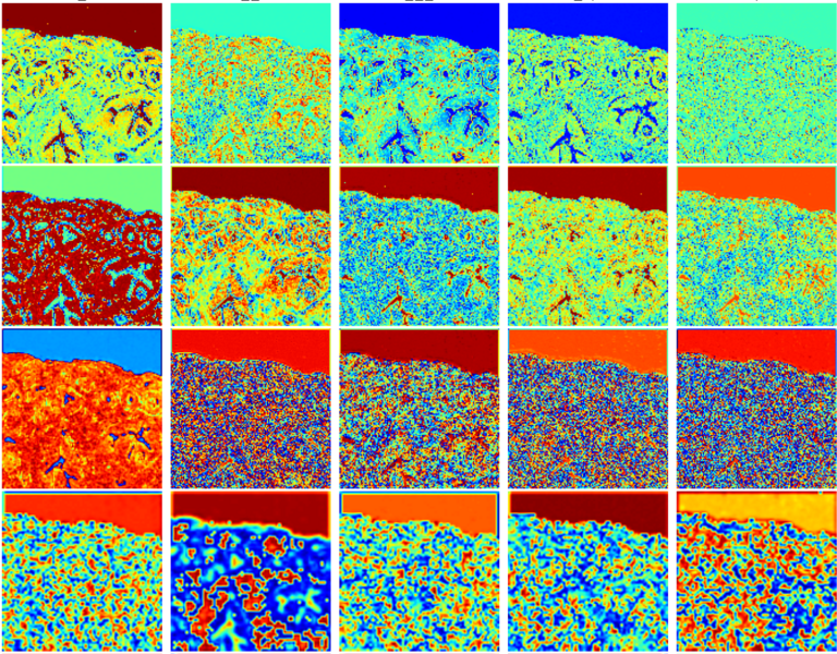 Activation maps of neural network model for digital staining of tumors