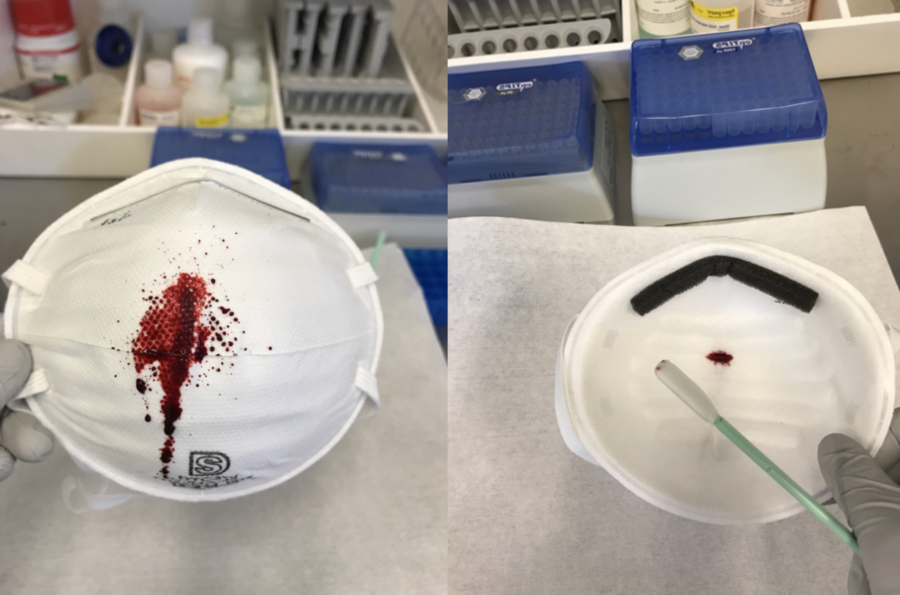 The laboratory is using synthetic blood to test surgical-grade N95 and similar respirator masks’ resistance to blood spatter. Here, a mask has failed the test, as the liquid has soaked through to the other side. 