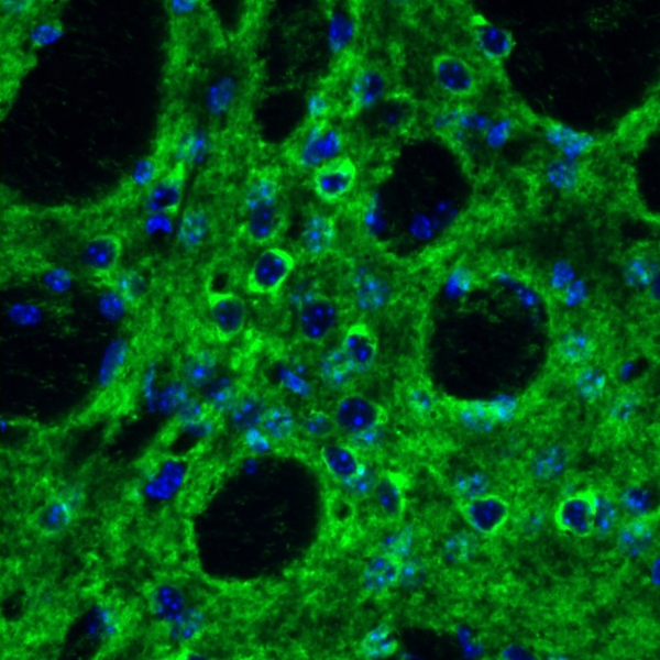 Researchers are studying the role of the immune system molecule IL-6 in Huntington's disease, which leads to neurodegeneration in a region of the brain called the striatum. In this figure from a prior study, green staining highlights Stat3 in the striatum. Stat3 is a major transducer of IL-6 signaling.