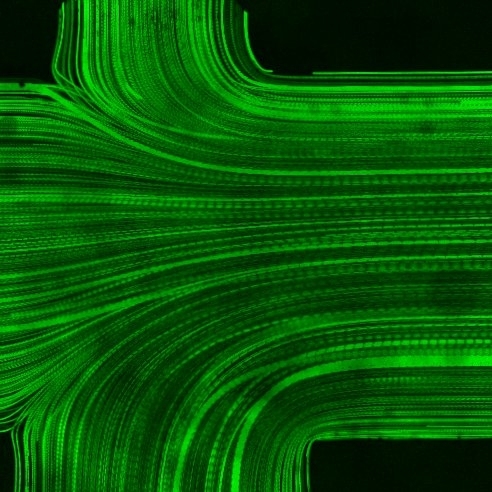 This is a time-lapse microscopic image of particle-based flow visualization inside a ventricular catheter. The image shows the confluence of three flows: the upstream flow coming from the catheter tip direction and two flows coming in via holes facing each other.