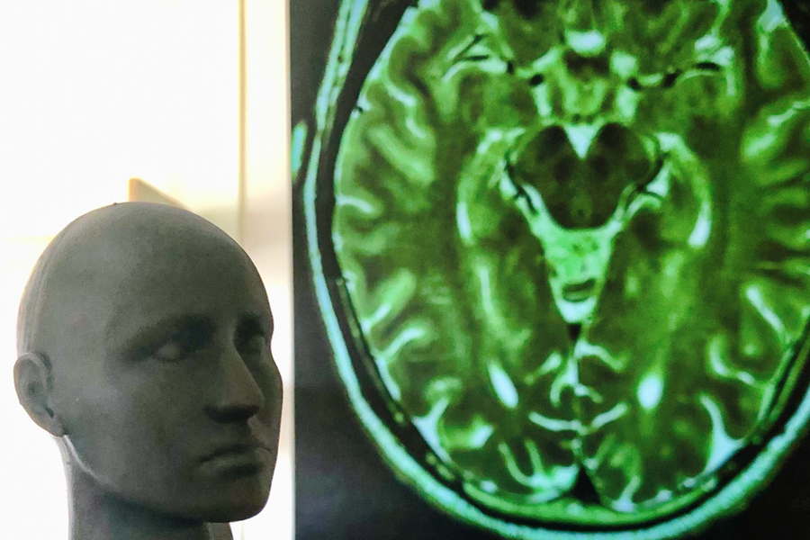 brain map shows fusiform area
