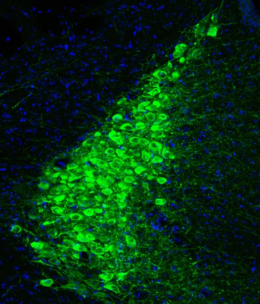 Image of a glowing green clump of cells in a teardrop shape