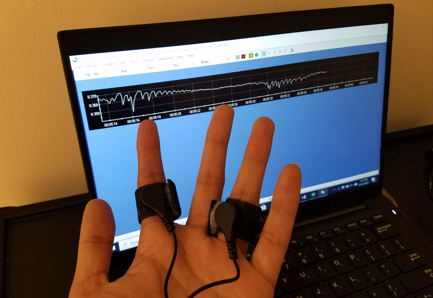 Photo of a hand with electrodes around two fingers, in front of a computer screen