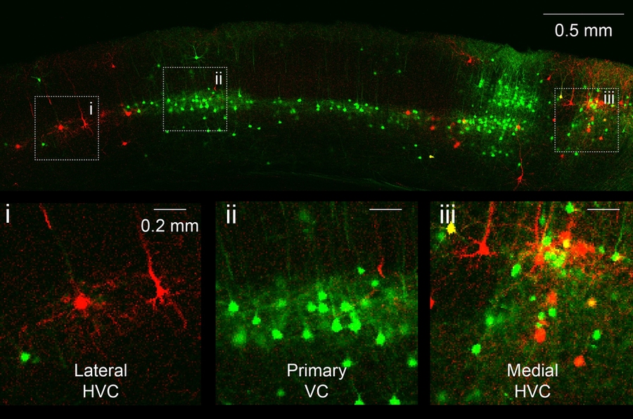 Image of highlighted neurons from sections of brain tissue glowing green or red.
