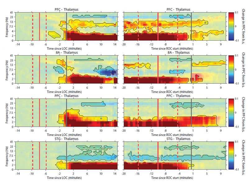 Eight horizontal images shows stripes of color moving across over a horizontal axis of time and a vertical axis of frequency.