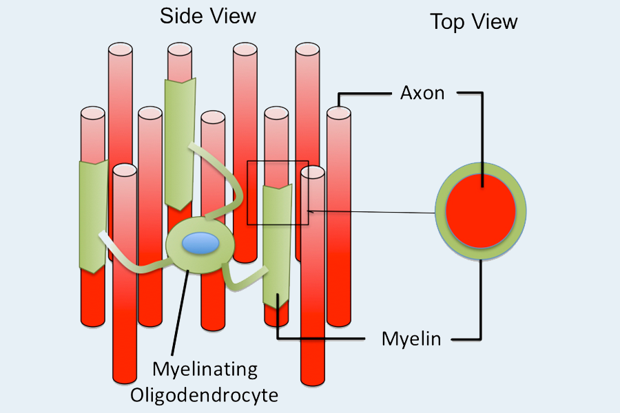 Illustration of about a dozen axons, aligned up and down, with green sheaths surrounding three of them
