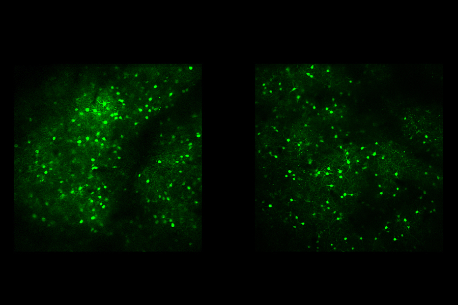 On a black background, neurons (dots) lit up in green cluster and form large blobs