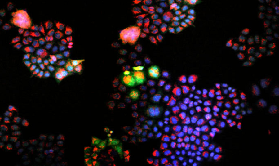 Photomicrograph of tumor samples, which appear as multicolored dots on a black background