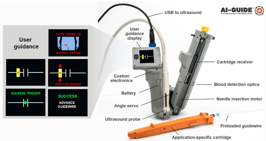 A graphic of the AI-Guide device with callouts labeling each part of the device.