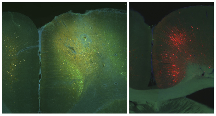 Two microscopic images of brain tissue. On the left the tissue is stained green and on the right the tissue is greenish and red. Both are seen on a black background.