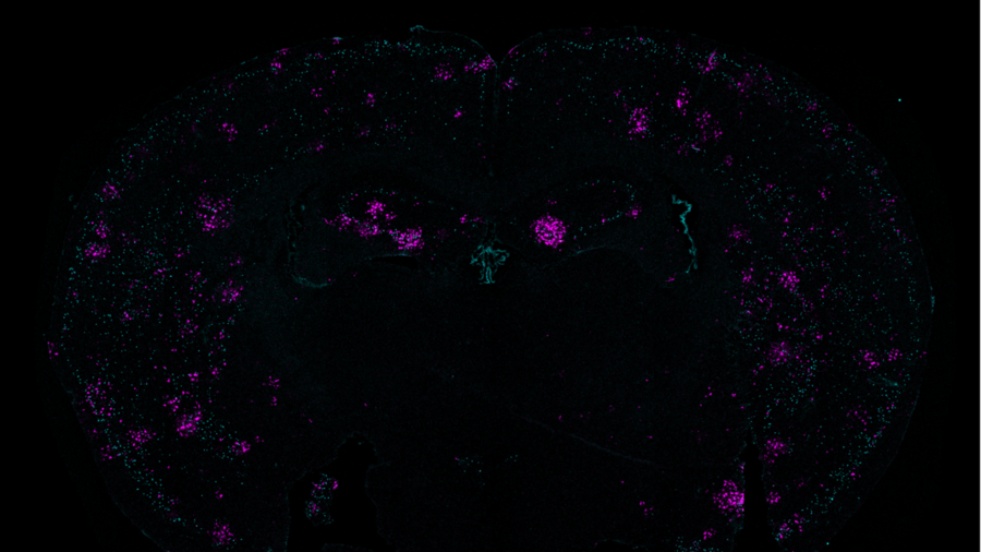 On a black background in the curvy M-like shape of a mouse brain cross section, many patches of tiny teal and purple dots appear