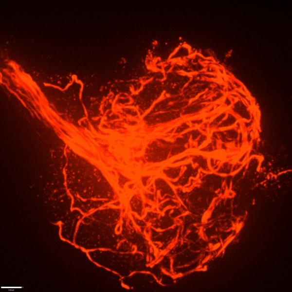 On a black background, a cable of bright red tubes comes into the frame from the upper left. The tubes quickly fan out into a big tangled ball in the center of the image.