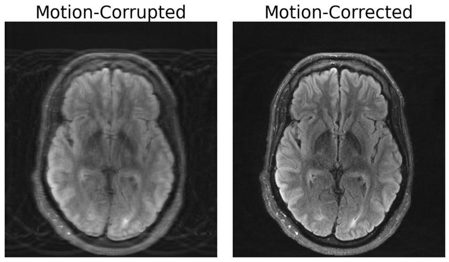 Two side-by-side black and white images of the same brain scan. The one on the left is blurry, and the label "motion-corrupted" appears above it; the one on the right is more clear, and is labeled "motion-corrected."