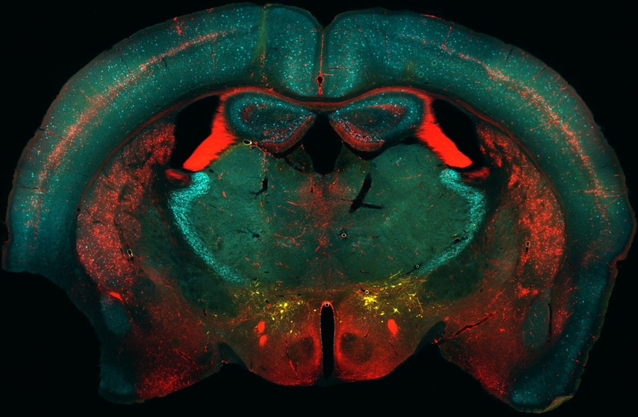 Microscopic image of mouse brain