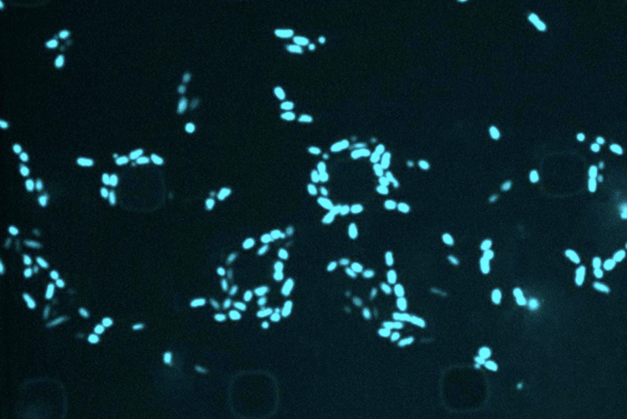 Image of round black circular cells surrounded by glowing blue pellet-like cells that are multiplying.