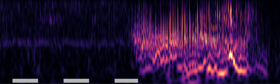 Colorful spikes depict neural activity at progressively higher stimulation currents. On the left, the colors are dim. On the right, they are brighter and warmer, indicating a seizure.