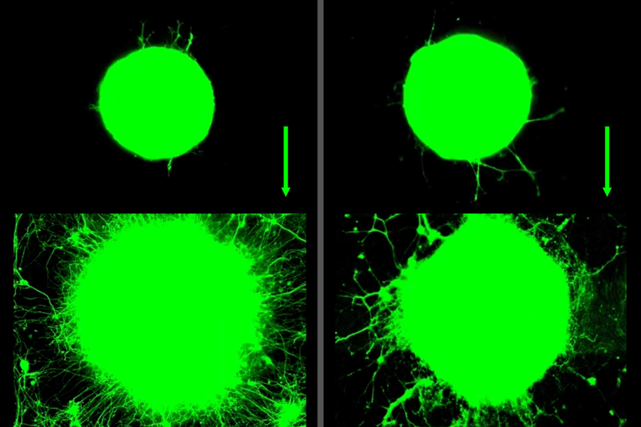 Two columns show, top, circular neurons. On bottom, they both have many tendrils growing.