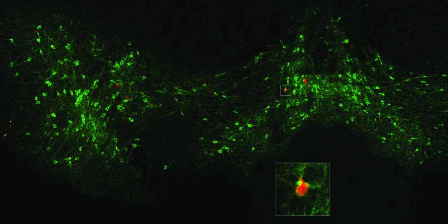Neurons glow green against a black background. A few red specks can be seen. An inset magnifies one of these cells that has red and green staining.