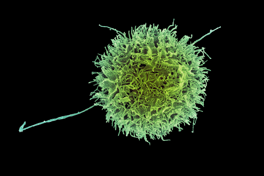 A human natural killer cell